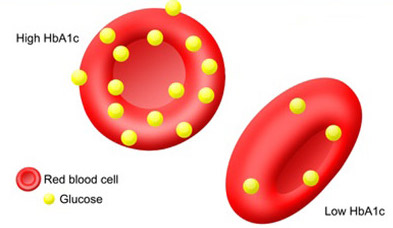 hba1c-diabetes-heartdisease