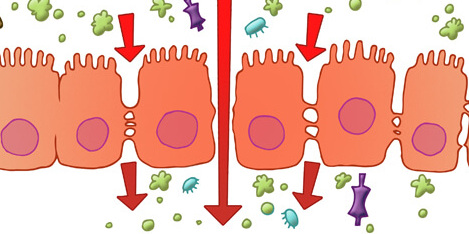 leaky-gut-intestinal-permeability